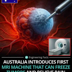 Máy MRI đông lạnh khối u đầu tiên ở Úc: Giải pháp không phẫu thuật, giảm đau nhanh chóng